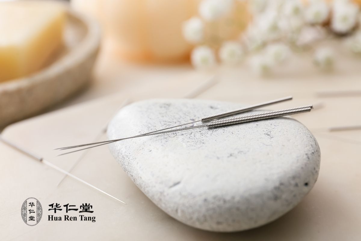 Bell's Palsy recovery guide showing treatment stages and expected outcomes